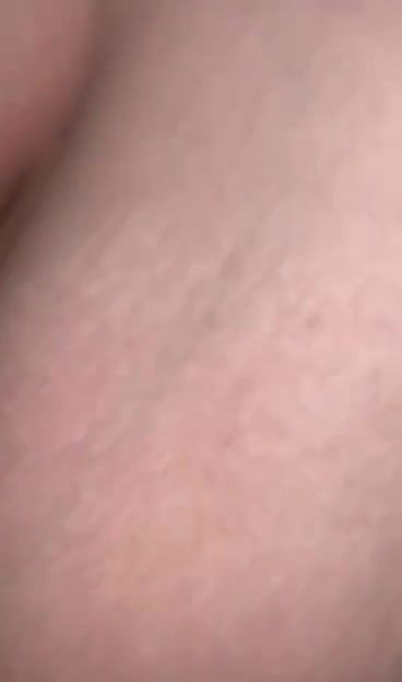 5 6154170922321319769