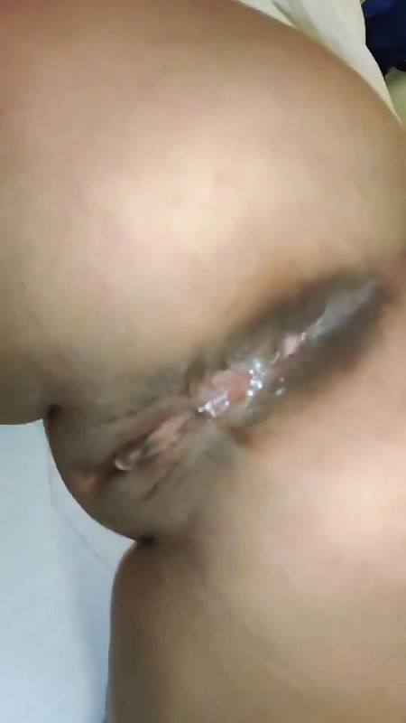 5 6167851110418618664