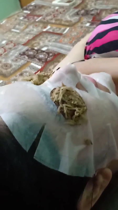 5 6303154726410128418