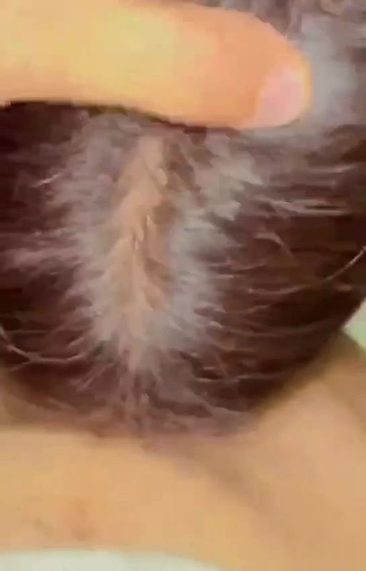 5 6206034074054695056