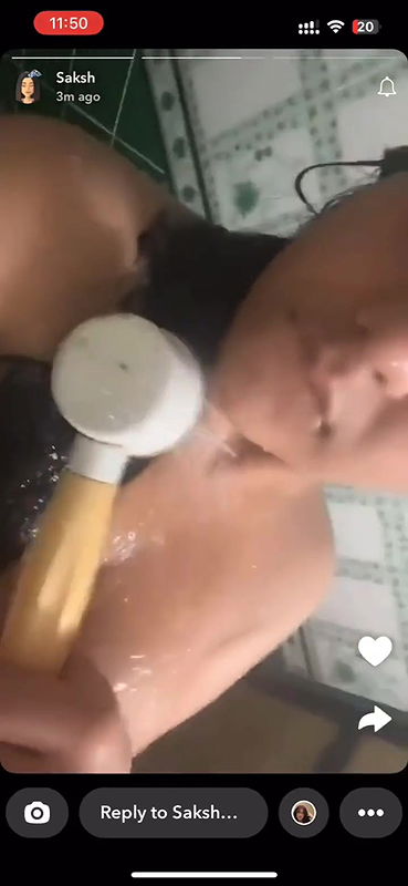 5 6170287383372633598