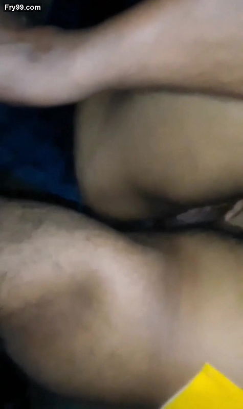 Penis pump treatment part 02