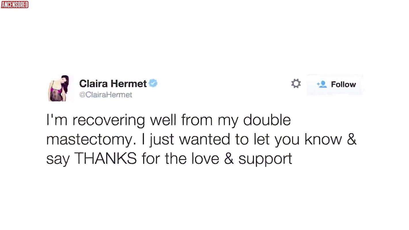Claira Hermet – goodbyeboobs