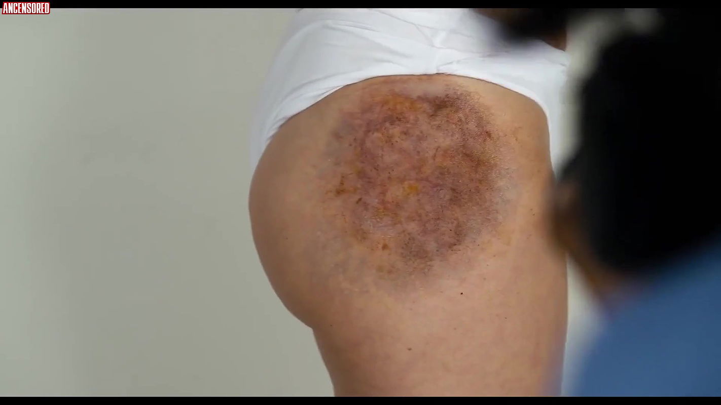 Emma Fitzpatrick – take back the night