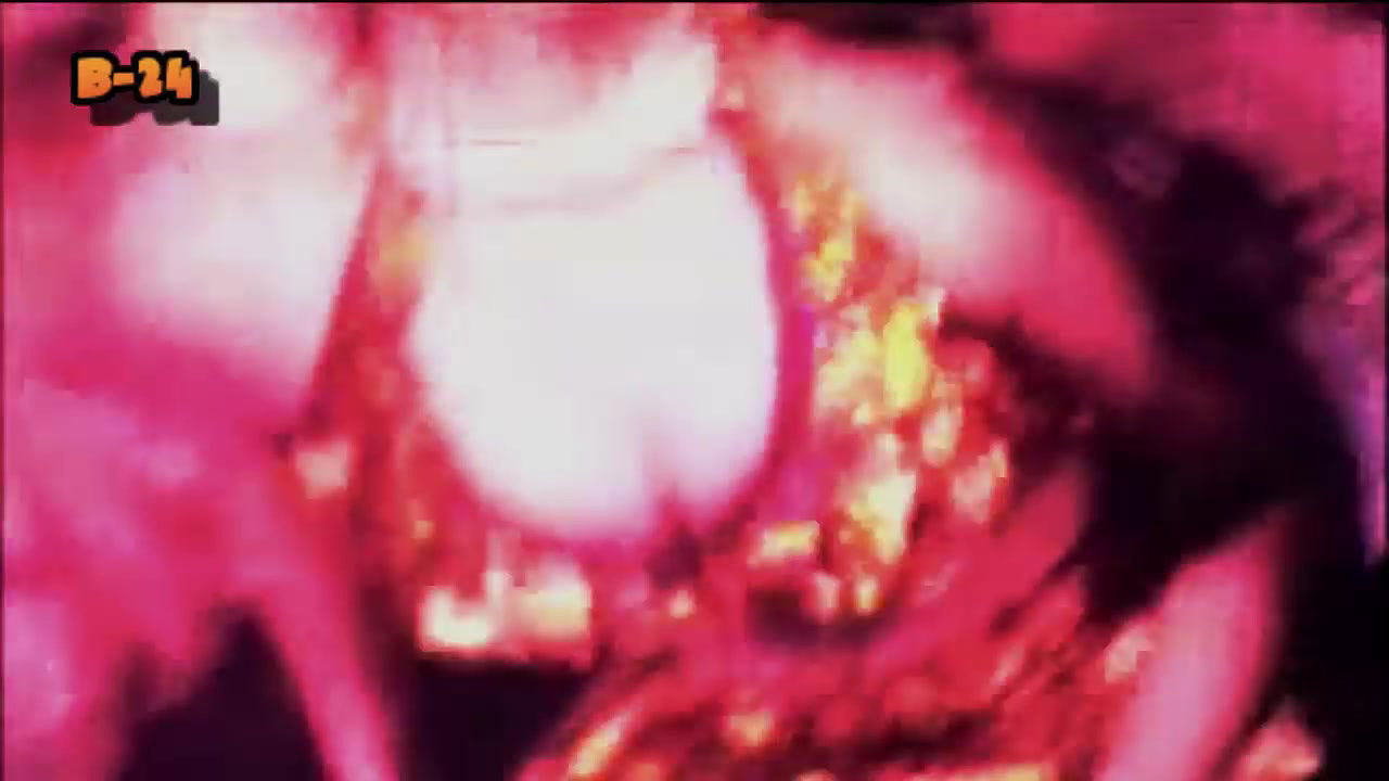 Random bengali B-grade Song -73