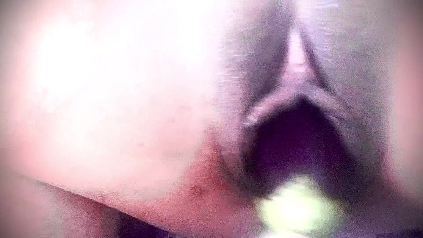 18 Years Tight Discount Unlocked with Thick Brinjal