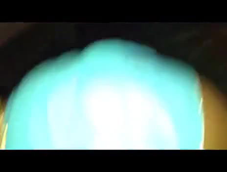 uhaag raat kay haseen lamhe khun nikal raha hai dheerayay karo