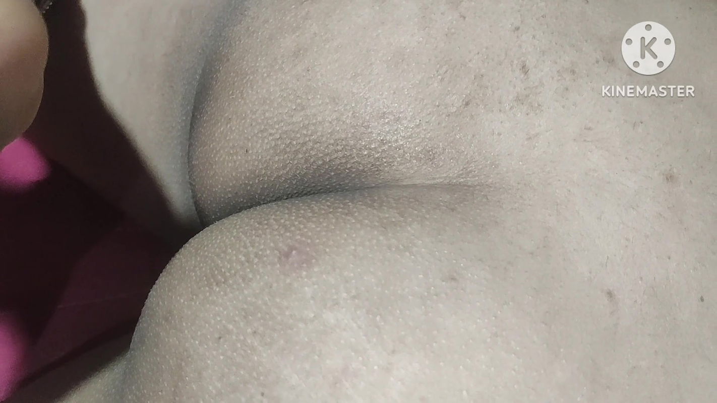 Fat Boobs