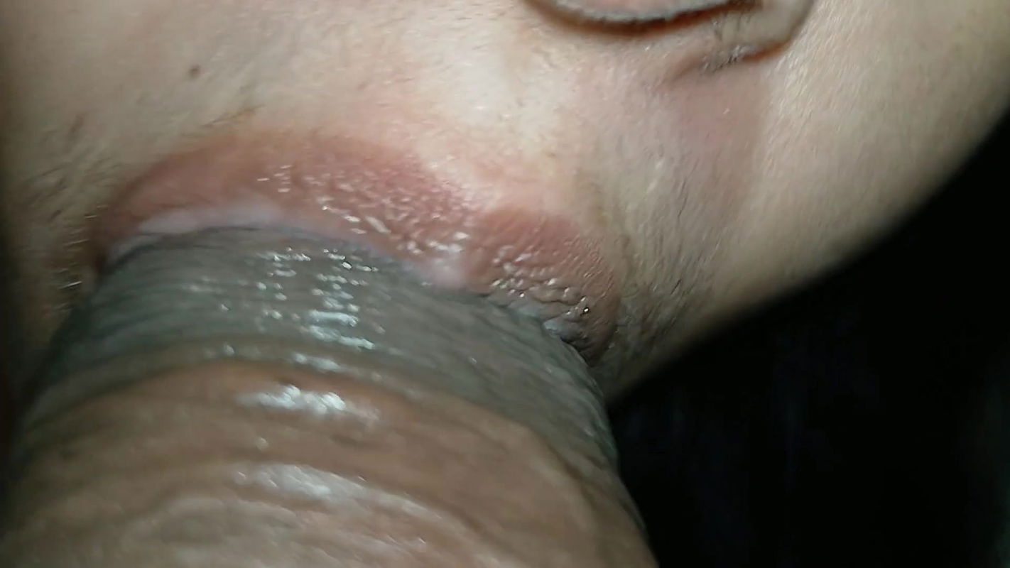 In the forest on a wet night, part 2