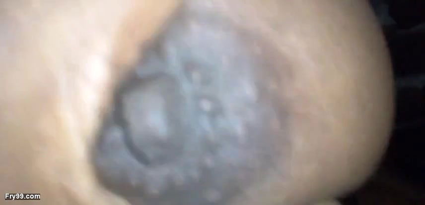 Chut me khujli ho rahi hai