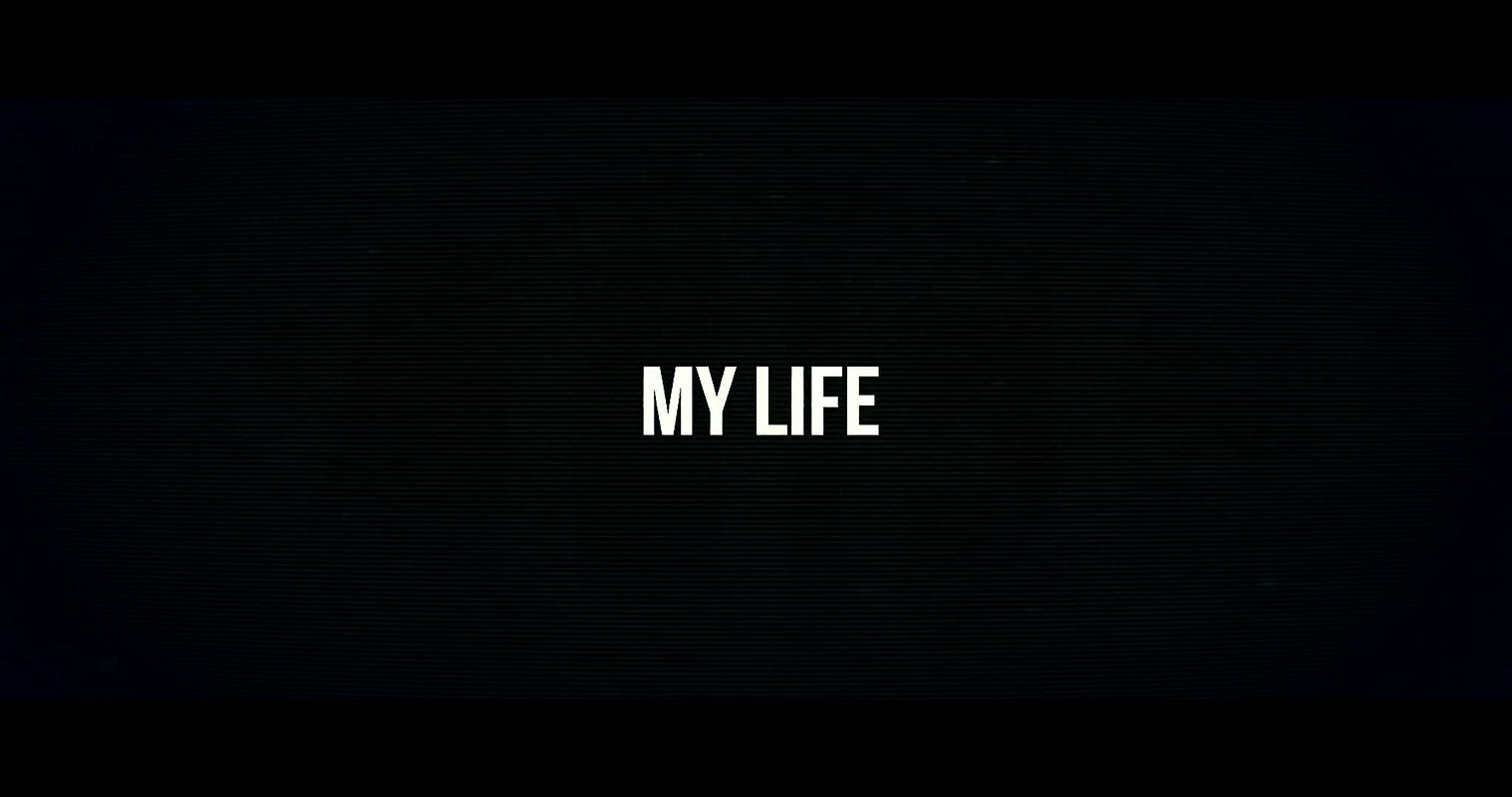 Huge Booty Colombian Albino Midget