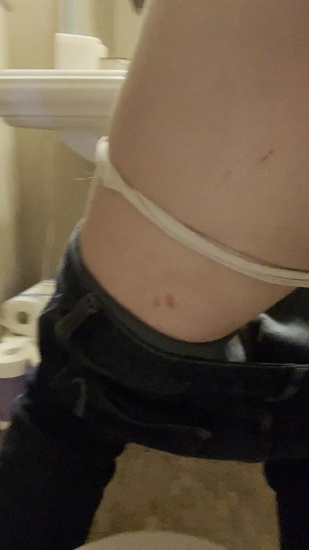 letsplay329 Messy shit running down my legs and filling my white thong
