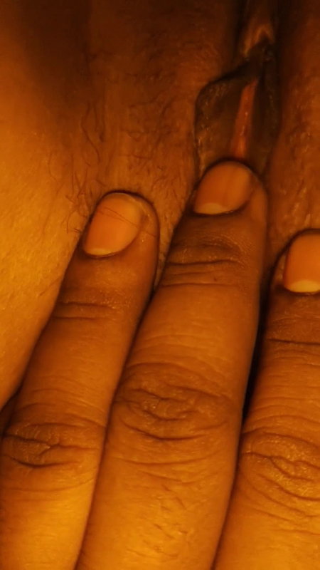 Sister-in-law’s rash itching mitigated