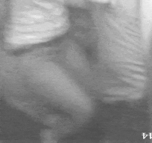 Desi Girl Boob Sucking by lover