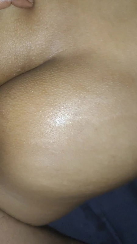 Sister-in-law’s oil was applied and dirt