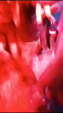 Myd nude dance videos collection – 61