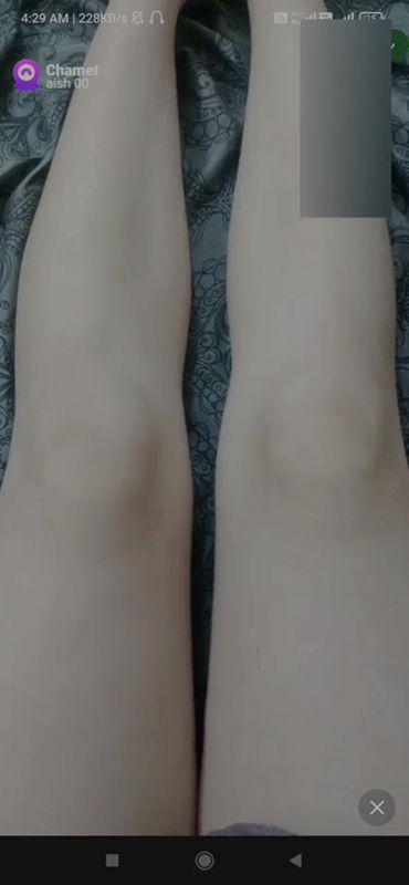 aisjh00 Chamet collection