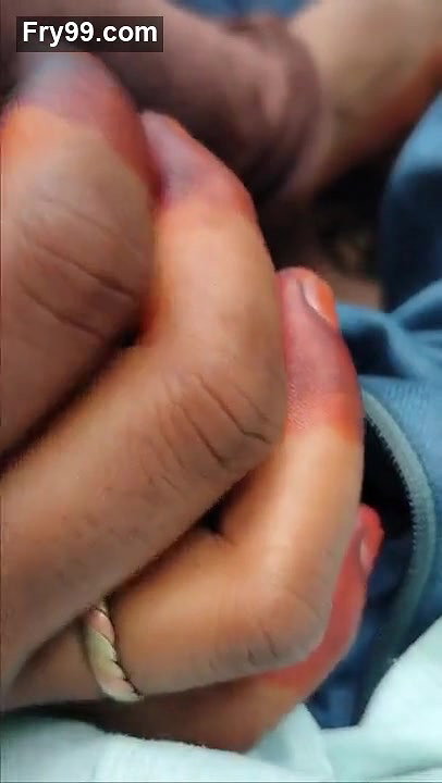 Telugu Gf Sucking Lover Dick In Outdoor