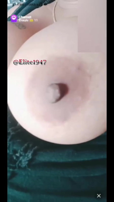 dimpl