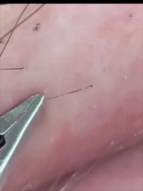 Hints to Detailed Smoothness