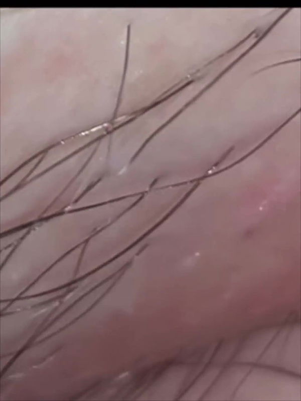 Hints to Detailed Smoothness