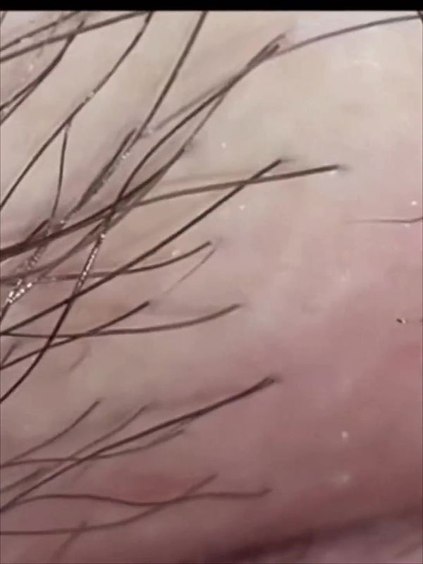 Hints to Detailed Smoothness