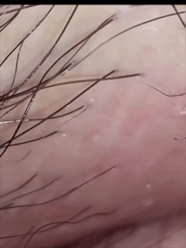 Hints to Detailed Smoothness