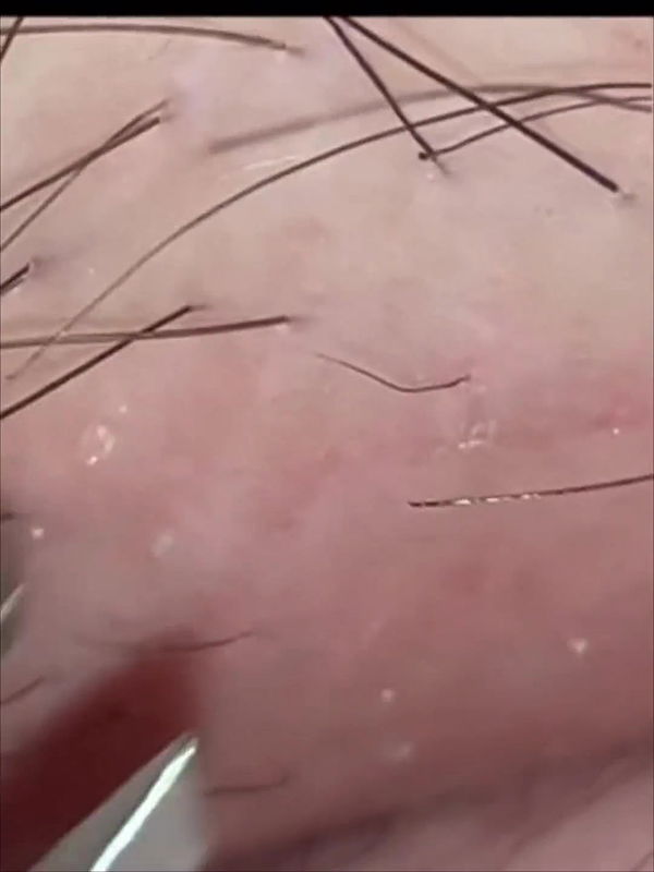 Hints to Detailed Smoothness