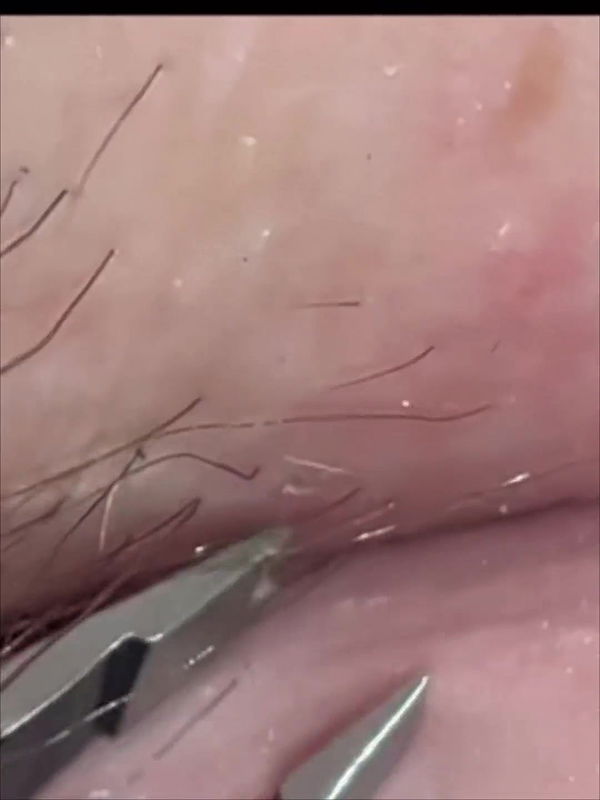 Hints to Detailed Smoothness