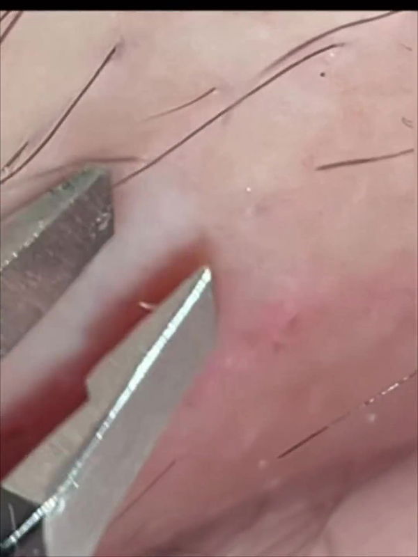 Hints to Detailed Smoothness