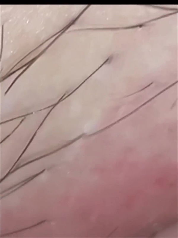 Hints to Detailed Smoothness