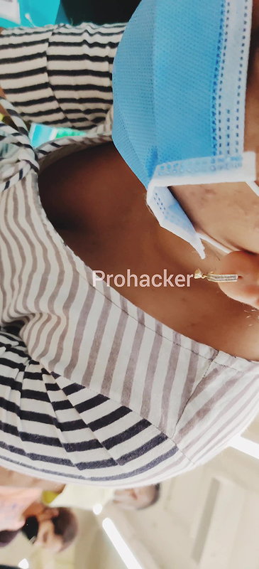 Downblouse bra visible, yummy boobs hanging