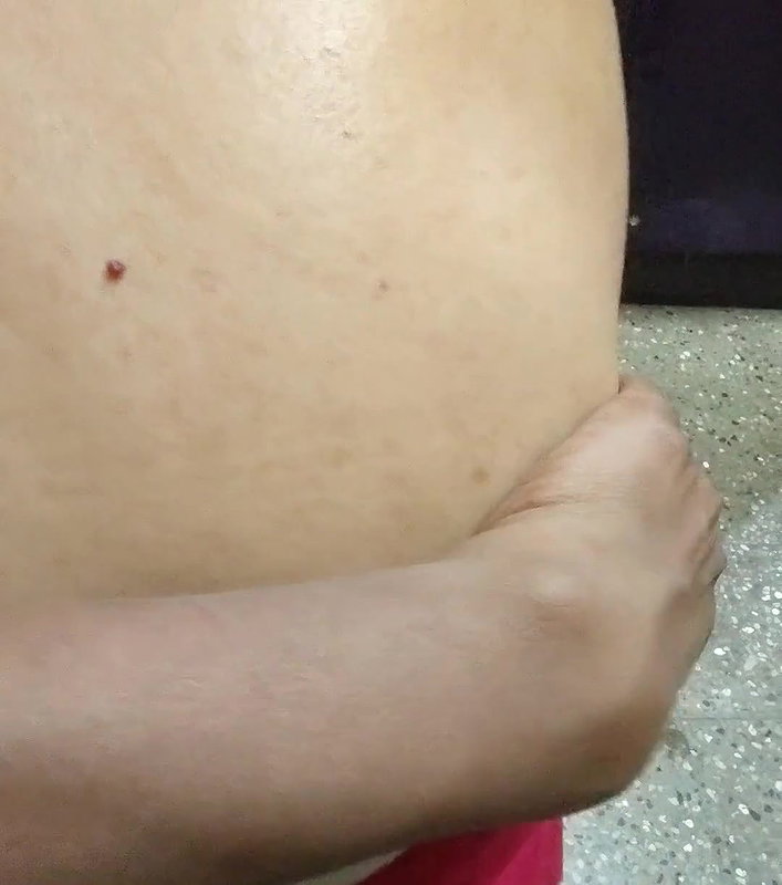 Auntie’s back massaged by her boyfriend.