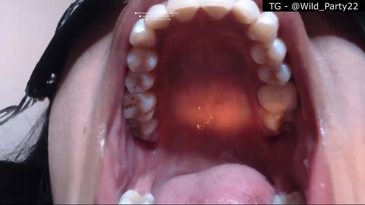 Zuby_duby 2 private show