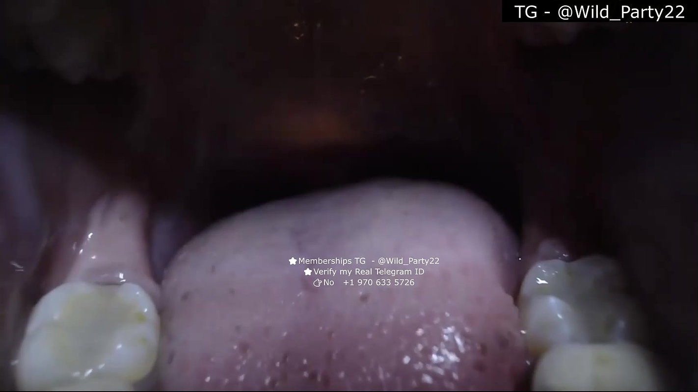 Zuby_duby 2 private show